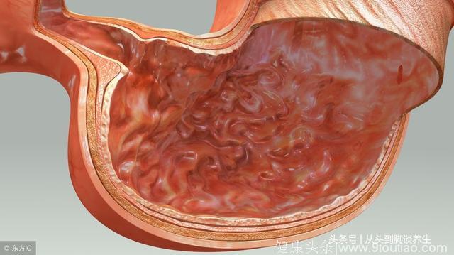 消化科医生：胃溃疡这4类食物要少碰，多吃1个食疗偏方修复胃黏膜