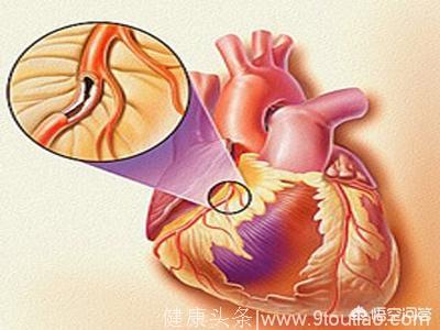 做到这4点，能让冠心病发病率降低50%！你应该知道