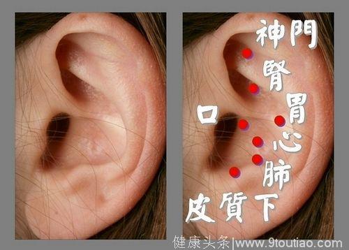 耳朵的这3个穴位，是隐藏的“特效穴” !坐骨神经痛、心绞痛都可治