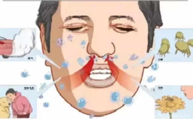 鼻炎犯了怎么办？热卖83年的印度鼻炎神器了解一下