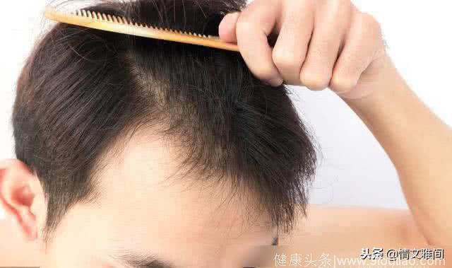 吴彦祖也被脱发困扰这4个因素，让中年男人逃脱不了脱发