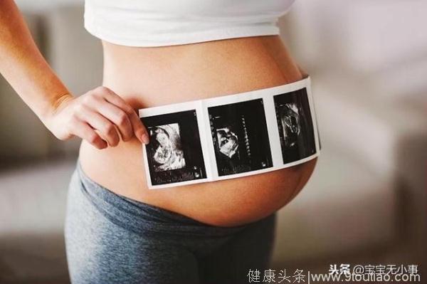 怀孕初期肚子就偏大？未必是胎儿发育得好，当心这4个因素