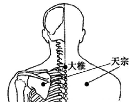 肩周炎别着急，学会这5个小动作，10分钟缓解肩周炎，拿走不谢！