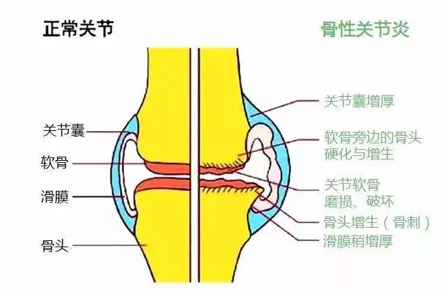 10个图解动作，4大养护方法，打开膝盖隐藏修复开关，赶走关节炎！