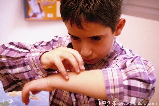 小孩皮肤红痒过敏怎么办？看看医生给的建议和小方法吧！