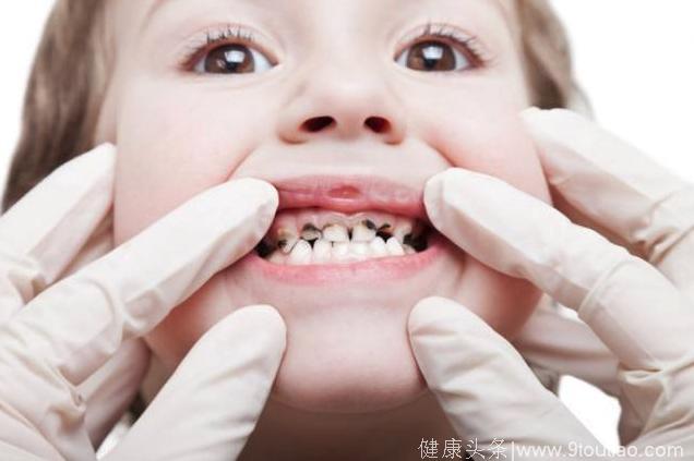 牙齿不好会影响儿童生长发育！宝妈们千万别把蛀牙不当回事
