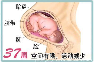 孕晚期妊娠高血压，医生让37周剖腹产，孩子会不会太小？如何选择