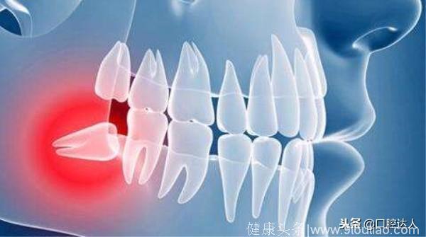 口腔中的“恐怖分子”，已有好多人被袭击了