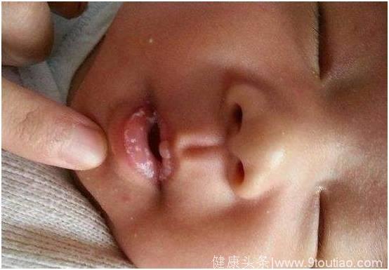 宝宝又哭又闹，嘴里还经常有白色的东西，宝宝究竟是怎么了？