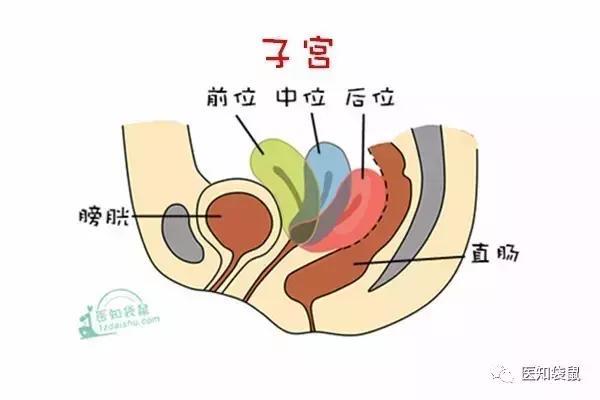 子宫前位、后位，女人哪种子宫最易受孕？