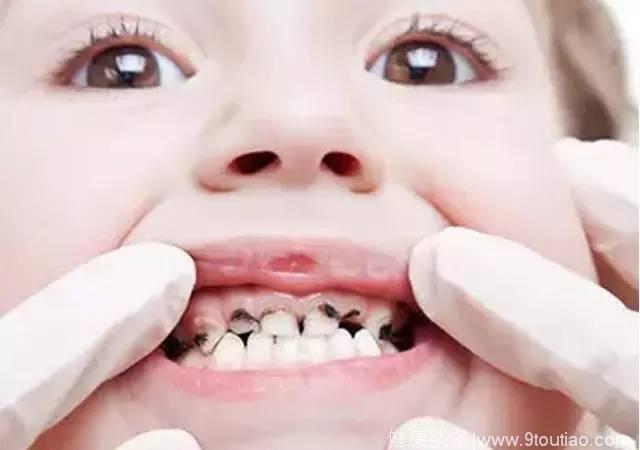 儿童口腔专家：这8种情况，家长一定要带孩子去看牙！