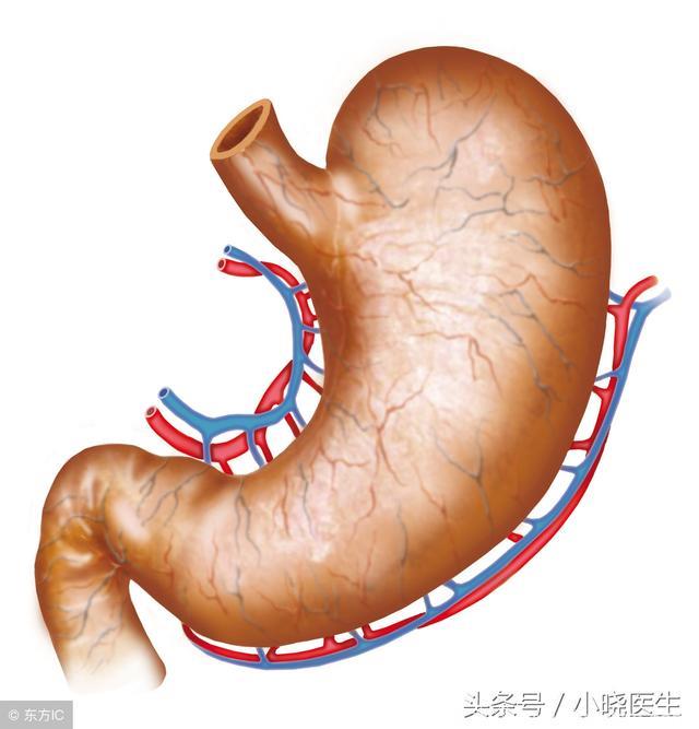 慢性胃炎如何筛查？避免癌症发生