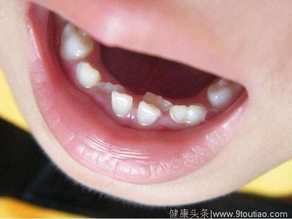 宝宝一口好牙，吃嘛嘛香，孩子牙齿的3个关键时期，家长需重视