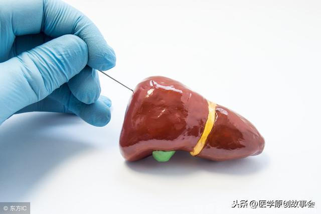 这个部位长了痣，最好去检查一下肝脏，肝硬化可能已经找上你