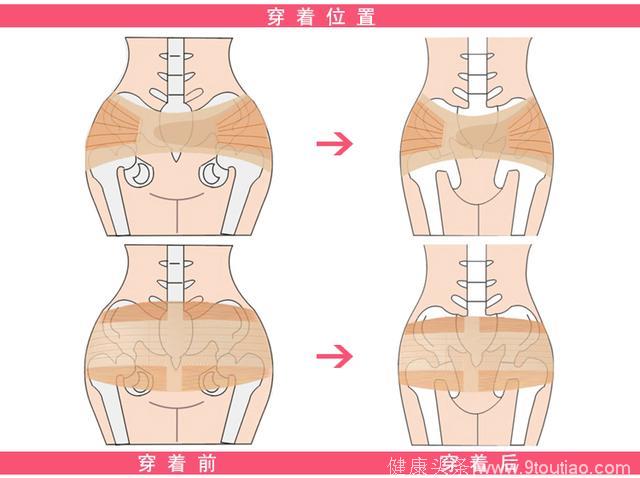 俗话说：屁股大好生养 真的吗？生孩子，你是不是易分娩体质呢？