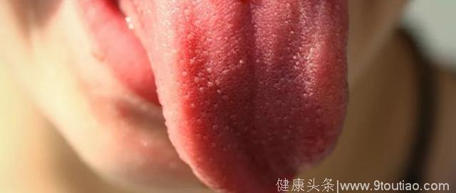 轻咬舌头也是一种养生，男人可强肾，女人能养颜