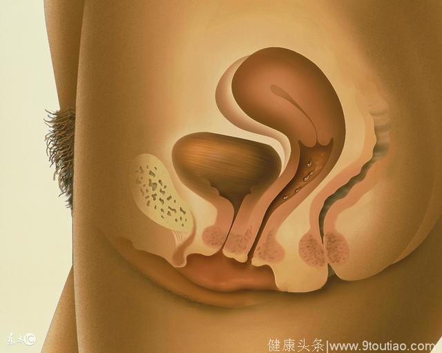 子宫内膜异位症应该怎样饮食呢