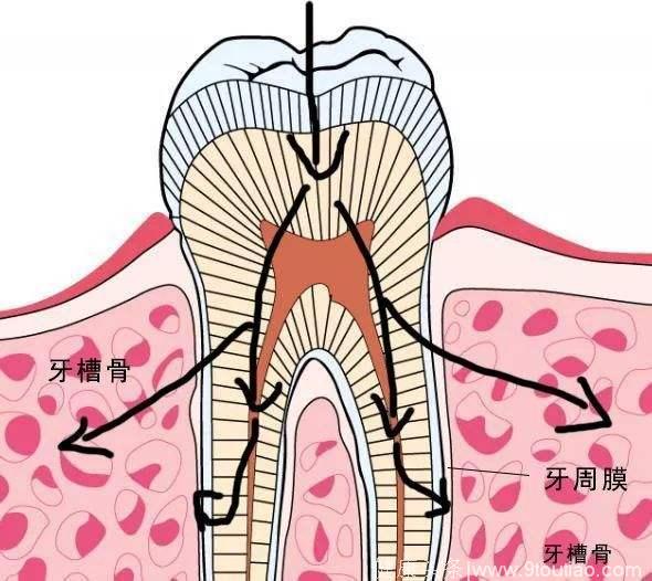 牙疼得寝食难安，病因可能在你的牙根里！