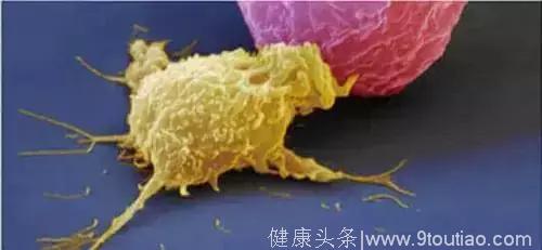 干货｜关于日本癌症细胞免疫治疗技术，你想知道的都在这！