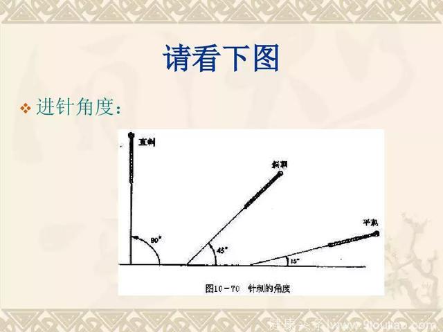 中医适宜技术——针灸！收了吧！