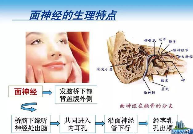 面瘫的针灸治疗！收了吧！