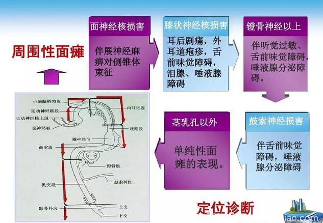 面瘫的针灸治疗！收了吧！