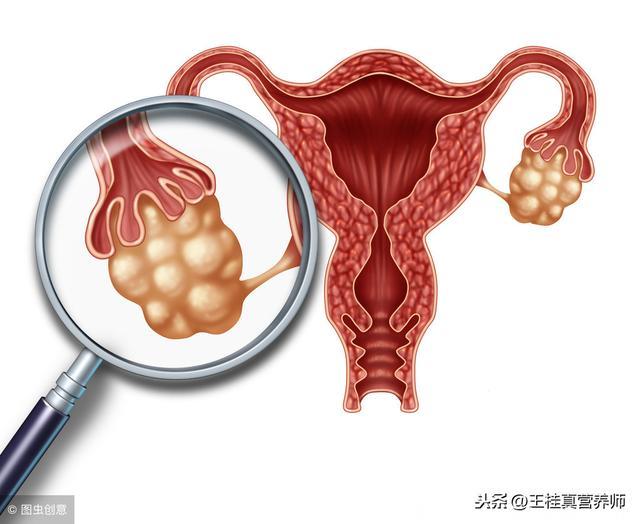 靠谱的癌症检查并不多，这3种癌症检查最靠谱的方法您要记得！