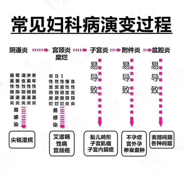 妇科医生：3个方法摆脱妇科炎症，抑菌养阴，滋养修护，保护子宫