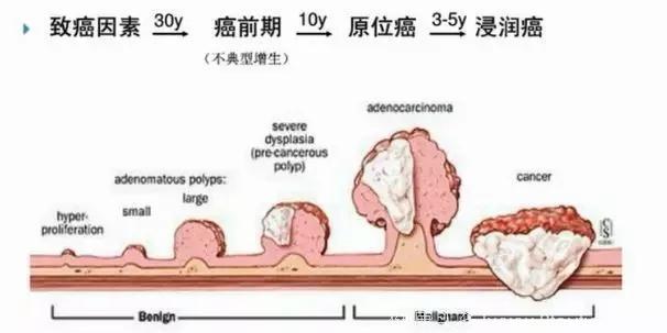 癌症从发生到被发现，最快需要多长的时间？答案出乎意料