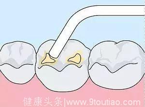 牙疼才去看牙？牙科最良心科普都在这里了！