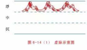 最全的入门脉诊知识，附详细图解（建议收藏）