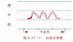 最全的入门脉诊知识，附详细图解（建议收藏）