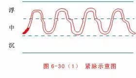 最全的入门脉诊知识，附详细图解（建议收藏）