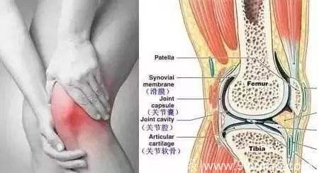 膝痛还能从“后”治！从腓肠肌入手治疗膝关节骨性关节炎
