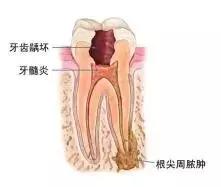 爸妈必看｜史上最全儿童口腔疾病合集（内附预防和治疗方案）