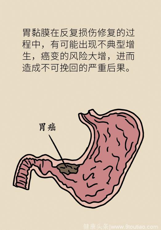 狼吞虎咽会将你带入胃癌的深渊，为了家庭，请细嚼慢咽