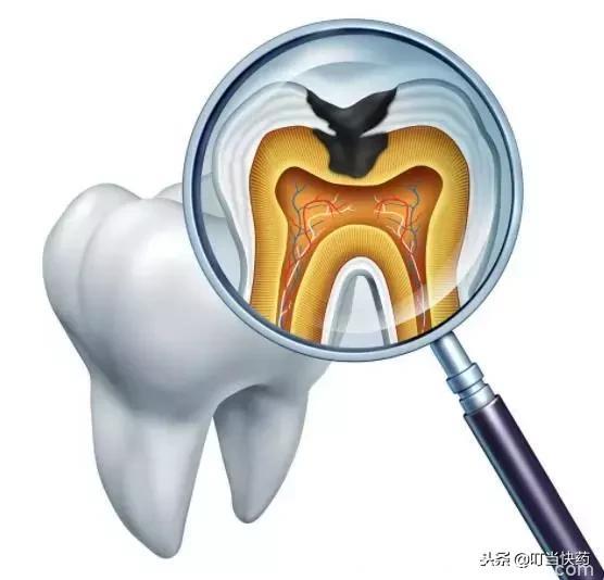 牙齿的寿命甚至超过人的寿命，掉牙有可能反应的是身体的疾病！