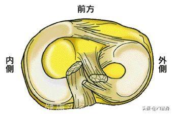 膝关节半月板损伤