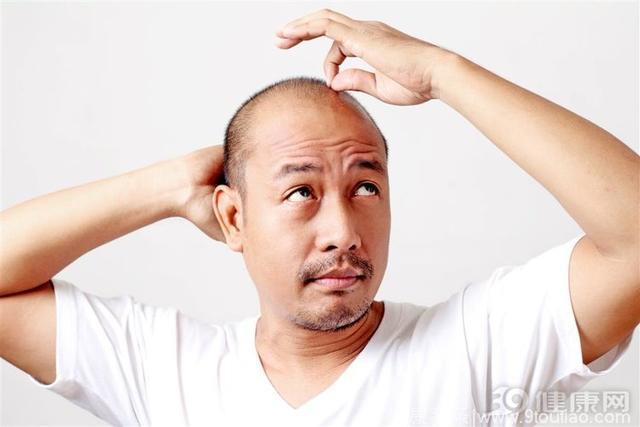 人到中年脱发，可能是这4个原因导致的！你占了几个？