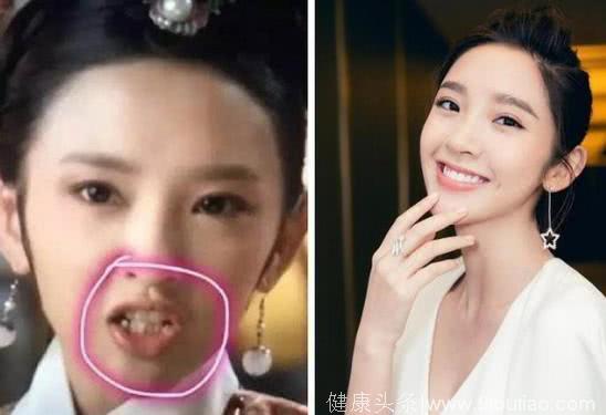 整牙之后有多美？看了这些女星，终于知道牙齿整洁的重要性了！