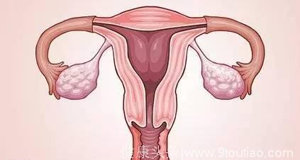 女性们注意！夜晚憋尿，会让癌症提前十年来报道，还会引发不孕