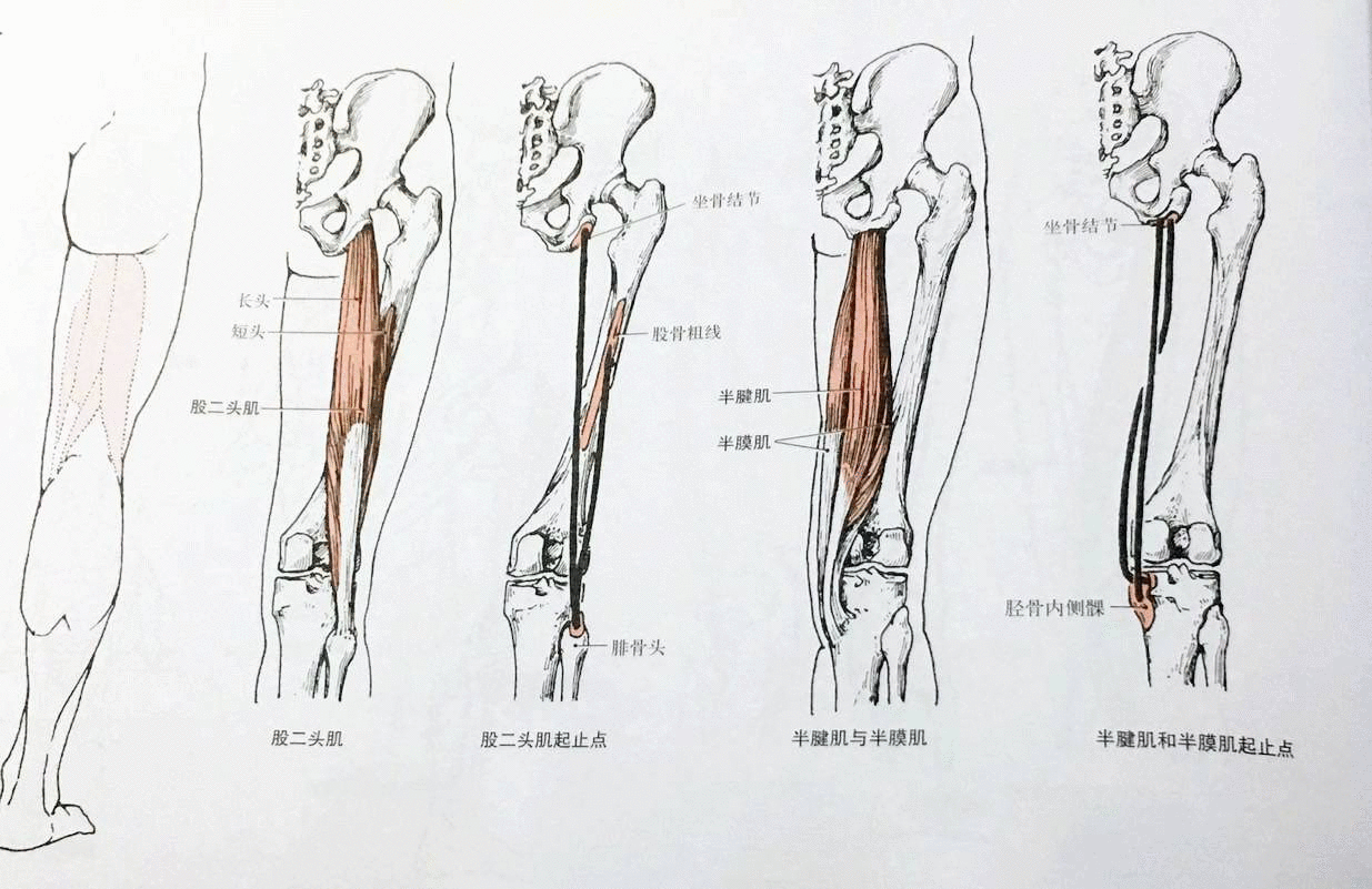 膝关节伸不直的问题