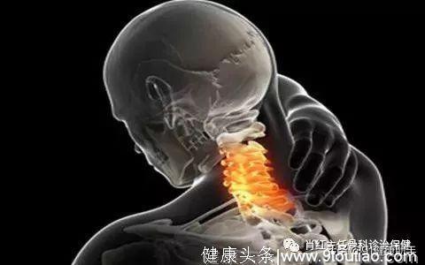 颈椎养护｜颈椎病的临床表现危害以及颈椎操