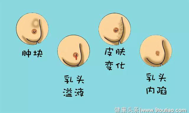 胸部摸到肿块？当心乳腺癌！