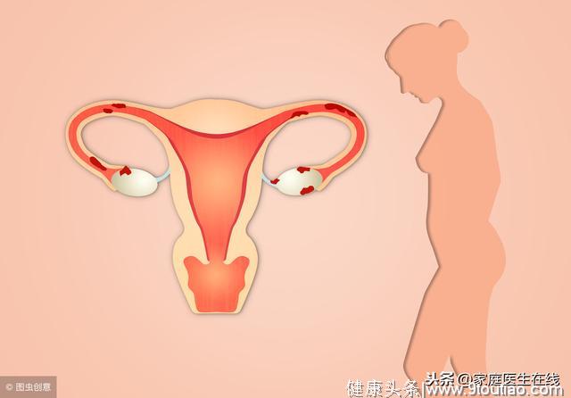 为何这么多的女性患上宫颈癌？恐怕是做错了五件事