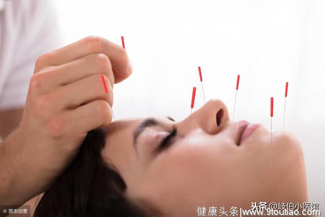 针灸治疗妇女血瘀型月经头痛