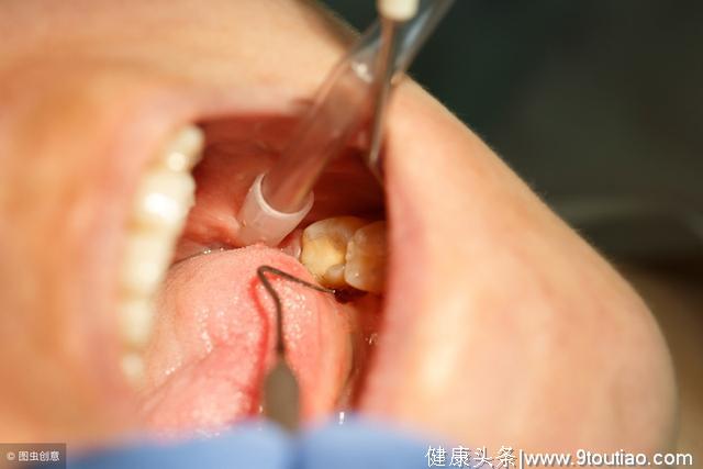 7个症状告诉你牙周不健康，糖尿病患者更需注意“牙齿危机”！