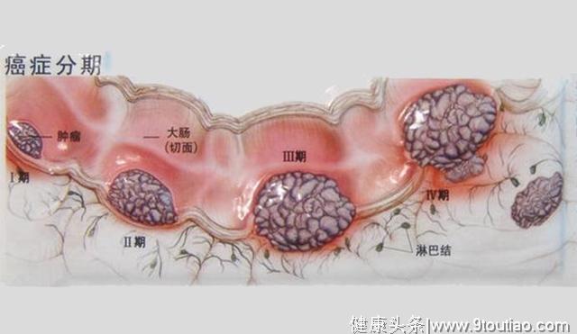 身体提示的这些信号不要忽略，可能是癌症发来的