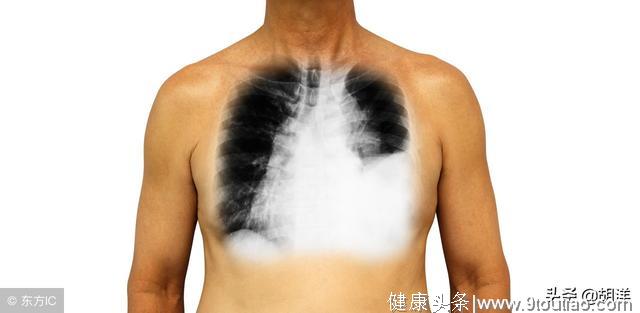 中国自主研发的抗癌小分子靶向药物，可以作为肺癌的首选治疗药吗