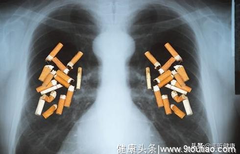 100个烟民，到底有多少人会得肺癌？出现这2种情况，离肺癌不远了